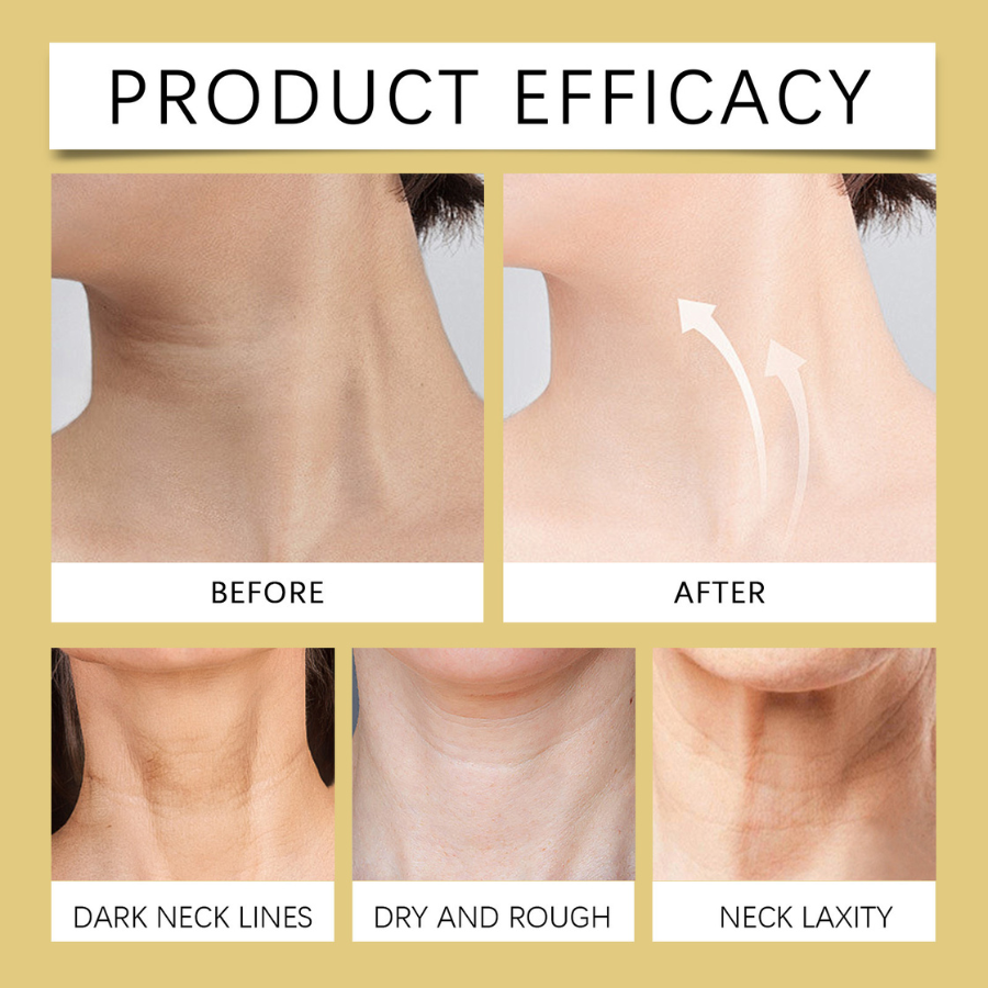 NixGlow™ Neck Cream